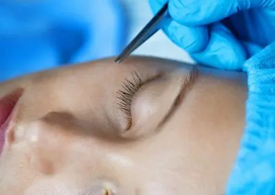 Cosmetic Surgery Claims