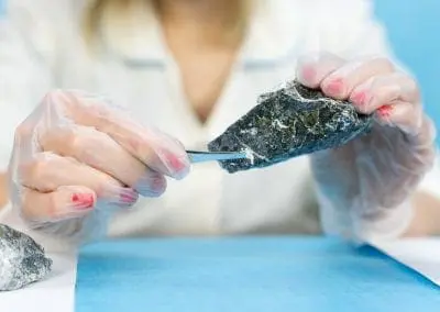 Mesothelioma Cases